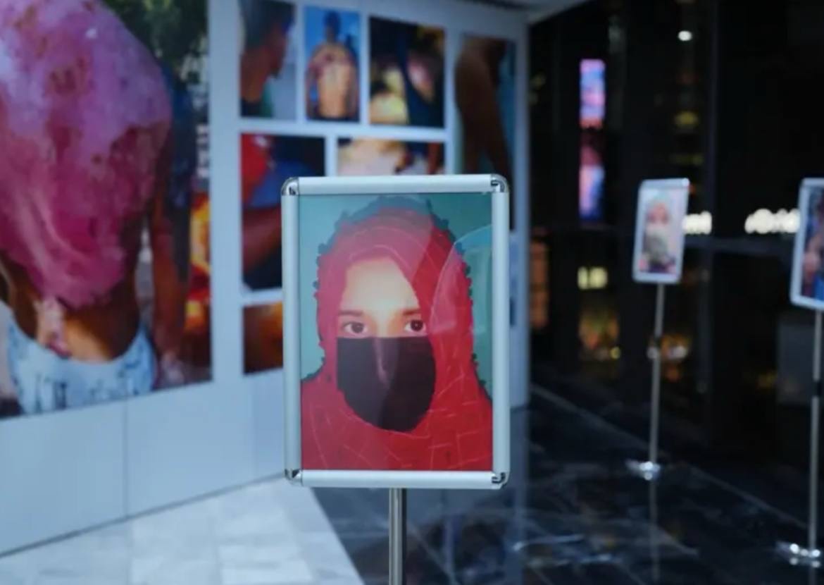 曼谷外国记者协会正在举办一场展览,讲述缅甸妙瓦底诈骗园区受害者遭遇的虐待